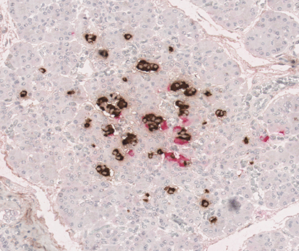 Pancreatic sample under microscope